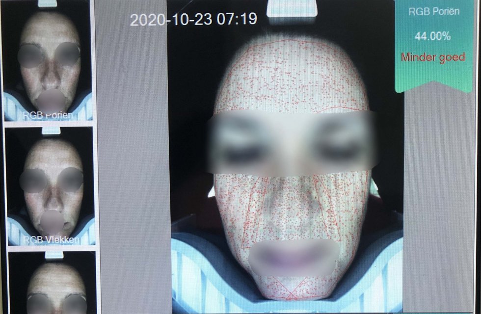 analyse huid abonnement