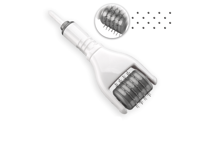 Tricopigmentatie roller - scalp pigmentatie - micro haar 
