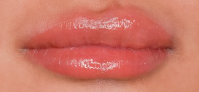 cleft lip dark lip neutralization