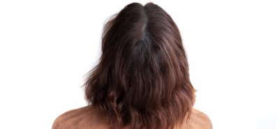 résultat de la pigmentation du cuir chevelu chez les femmes pour plus de volume dans les cheveux