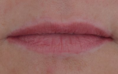 Rood pigment verwijderen 