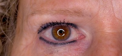 Microblading weglaseren 
