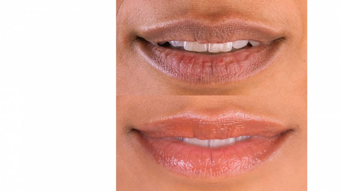 donkere lippen neutraliseren