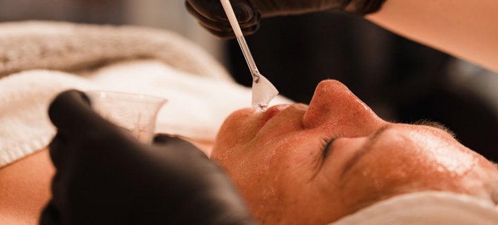 Mesopeel, diepe peeling abonnement huid