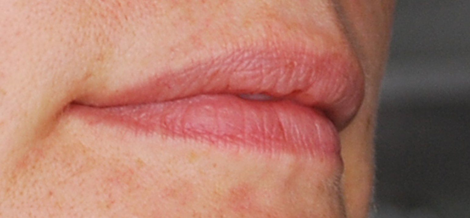 Le traîtement des lèvres naturelle permanent 