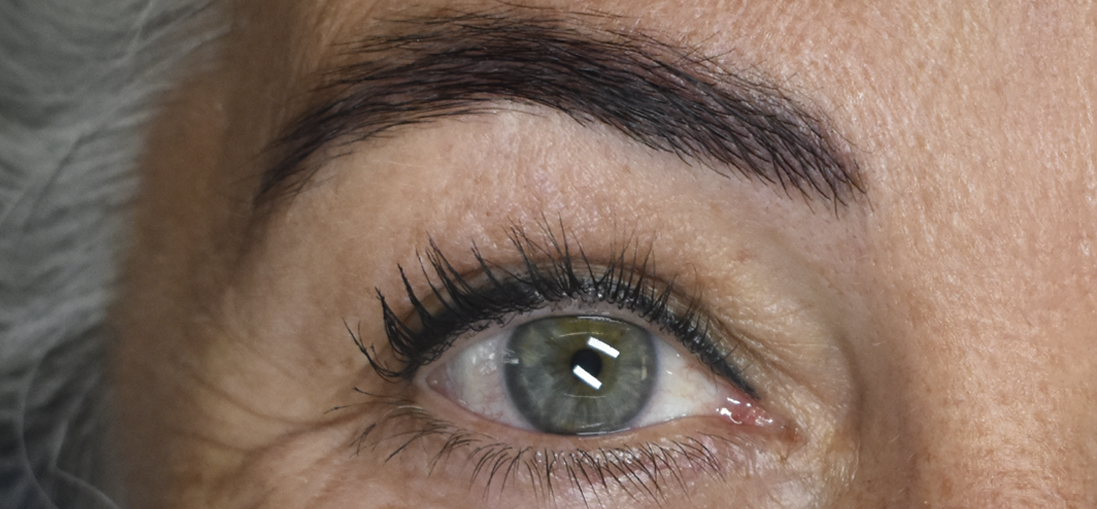 Rehaussement sourcils