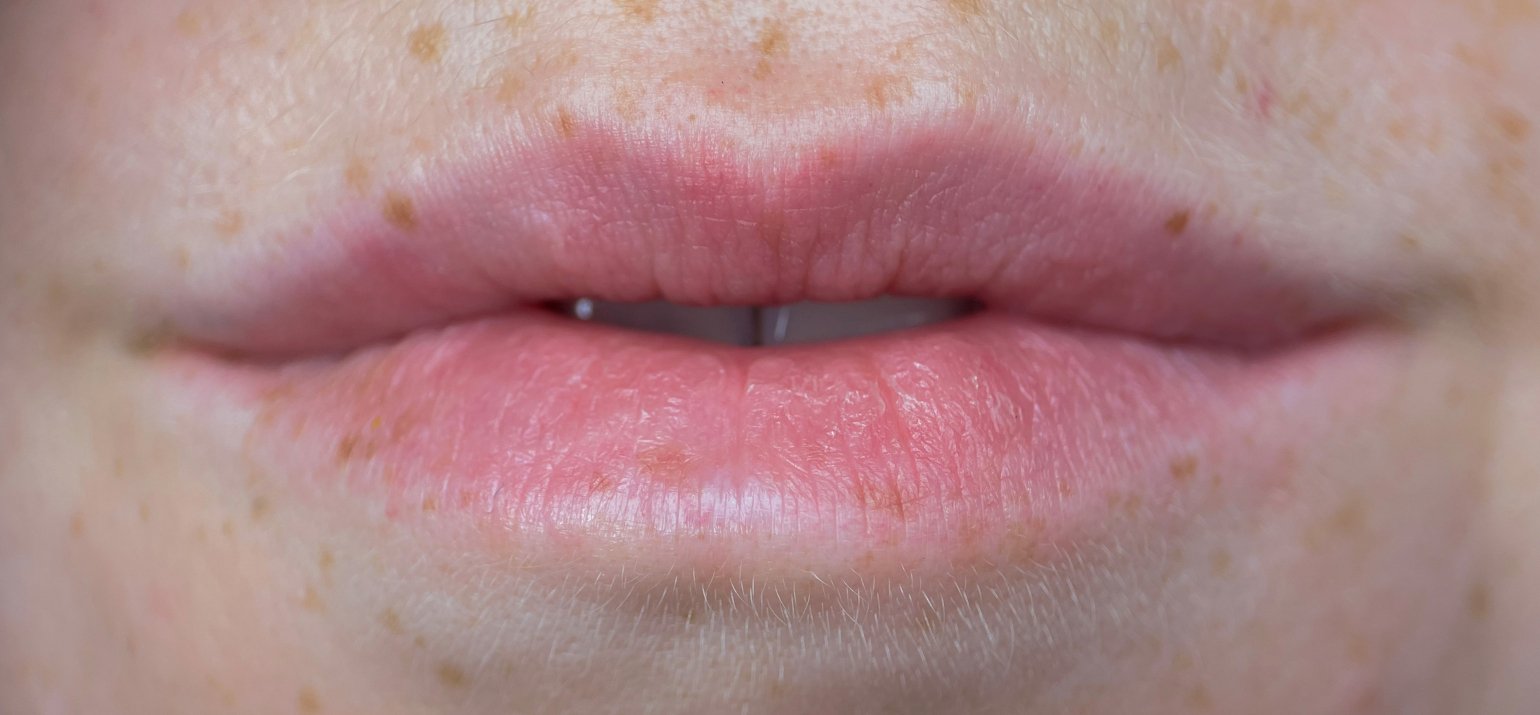 traîtement des lèvres pink permanent 