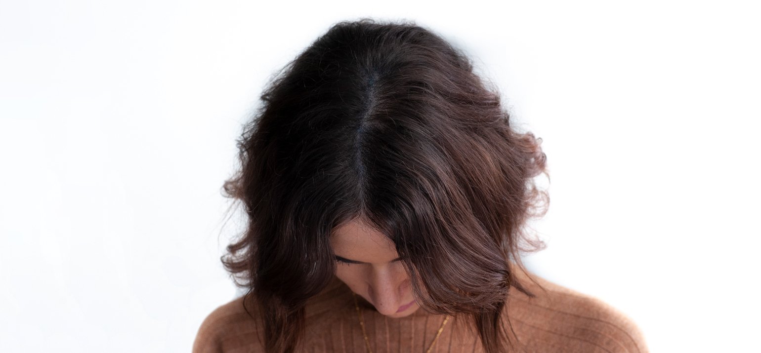resultat des tricopigmentation scalp micro pigmentation avec femme