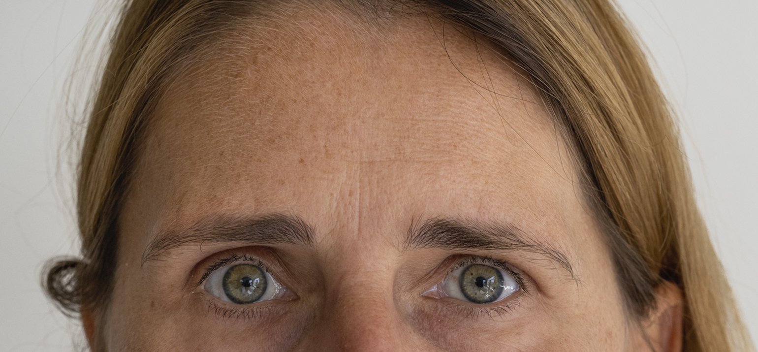 Behandeling antiaging resultaat kuur 