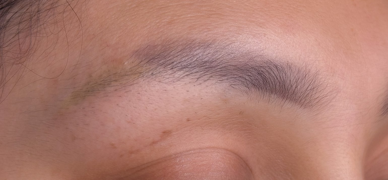 oude permanente make-up verwijderen met non invasieve laser 