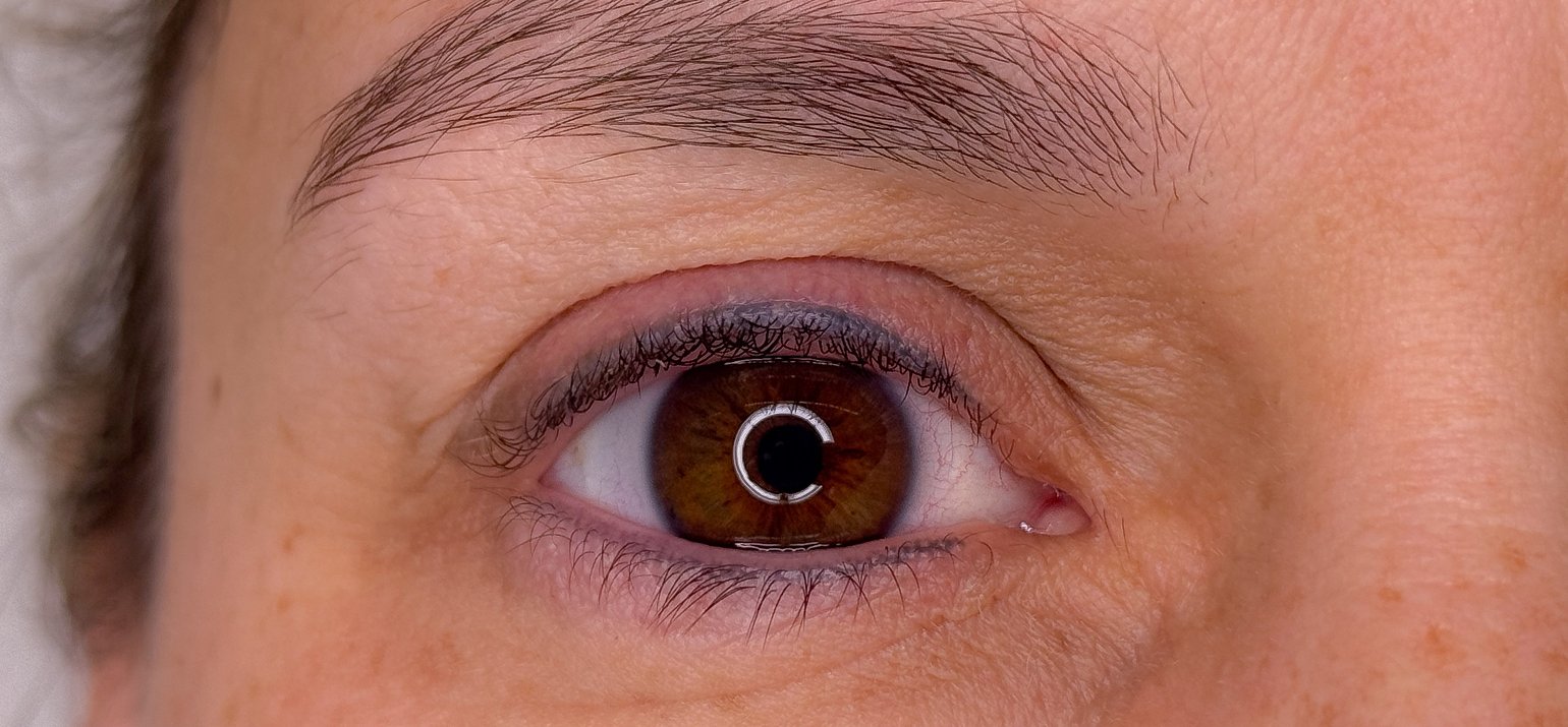 élimination au laser de l'eyeliner élimination permanente